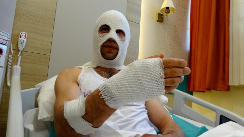 Erzurum - Nişanlısına hediye paketi hazırlarken patlayan sprey boya kutusu hastanelik etti /Video eklendi