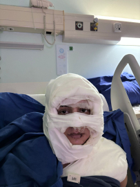 İstanbul - Kadıköy'de üzerine kolonya döktüğü kadını yakan sanık ilk kez hakim karşısına çıktı