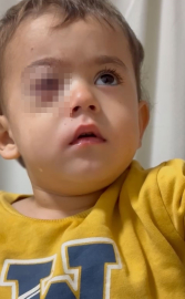 Bursa'da, 2 yaşındaki Alpaslan'ın görme yetisini kaybetmesine neden olan torpil, fırından alınmış