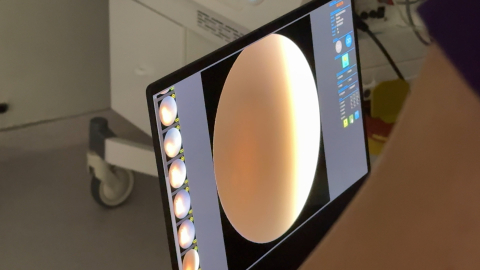 Rize'de 'prematüre retinopatisi' tanı ve tedavisi yapılabilecek