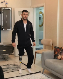 Akın motosiklet kazasında bacağını kaybetti, hayırseverler 450 bin liralık protezle yürümesini sağladı