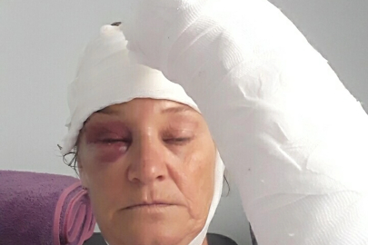 Köpek saldırısına uğrayan kadın korumadan eski patronuna suç duyurusu